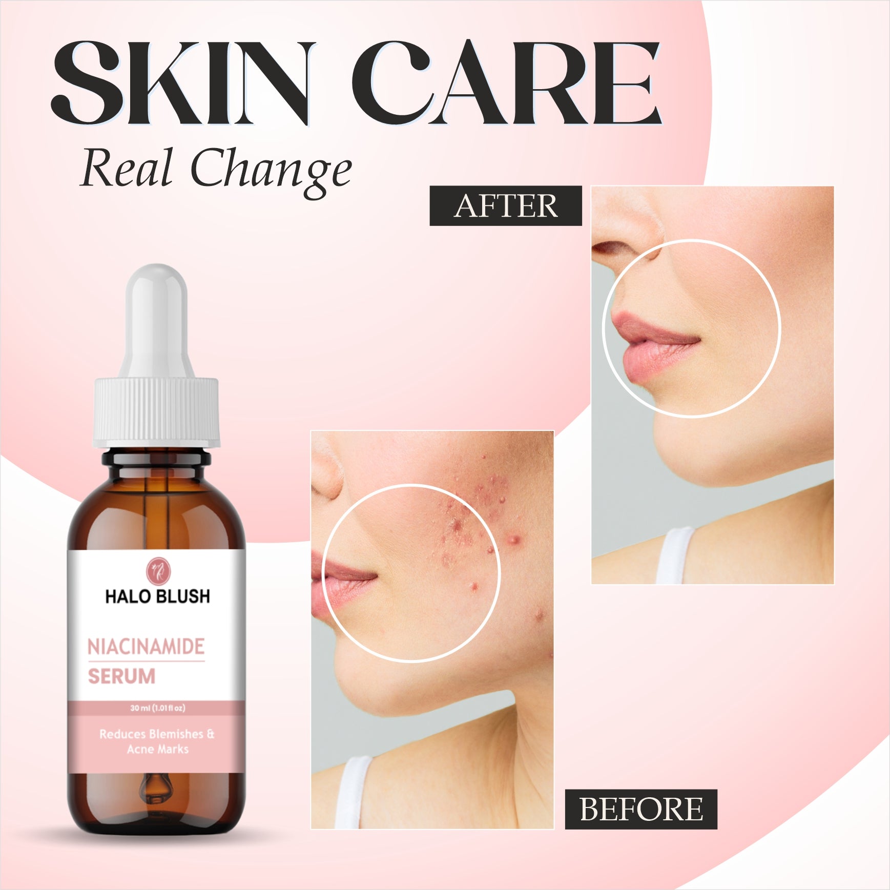 NIACINAMIDE FACE SERUM
