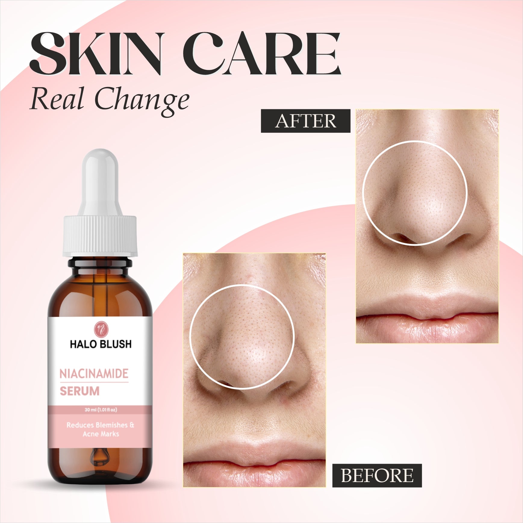 NIACINAMIDE FACE SERUM