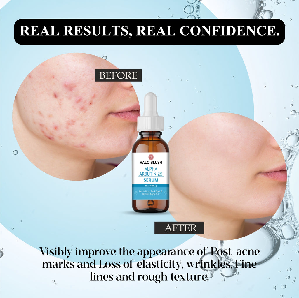 ALPHA ARBUTIN FACE SERUM